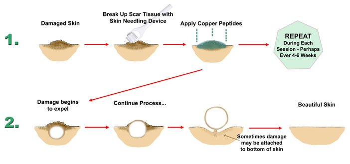 Current Dermaroller and Skin Needling Device Research