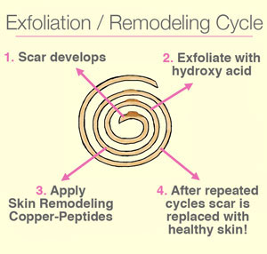 Exfoliation Cycle