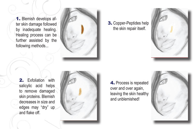 Scar Becomes Repaired and Removed