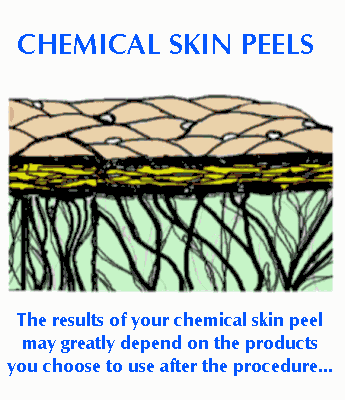 Chemical Skin Peels